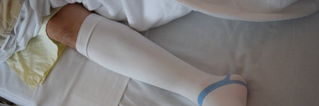 Compression stockings for preventing deep vein thrombosis (DVT) in