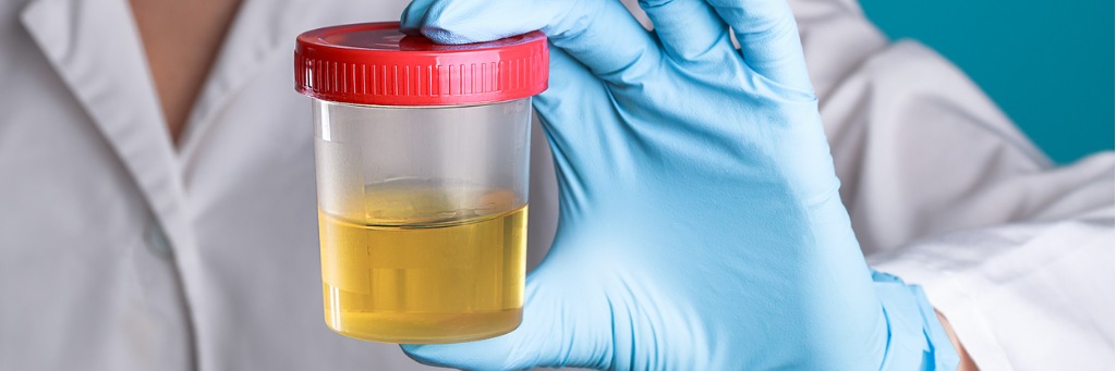 Do Women Know How To Take A Urine Sample 