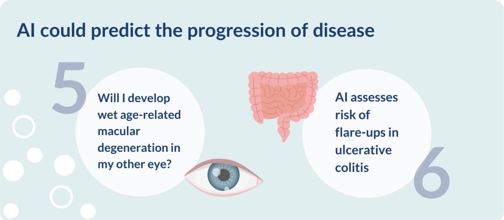 AI could predict the progression of disease

5- Will I develop wet age-related macular degeneration in my other eye?

6- AI assesses risk of flare-ups in ulcerative colitis