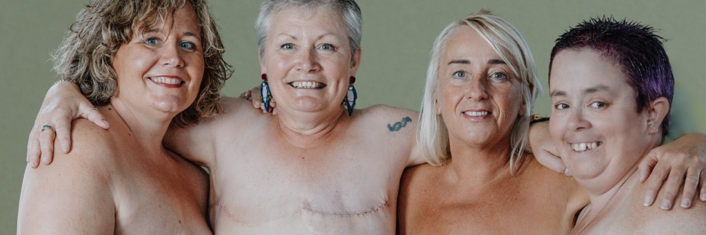 Women who have had both breasts removed following breast cancer
